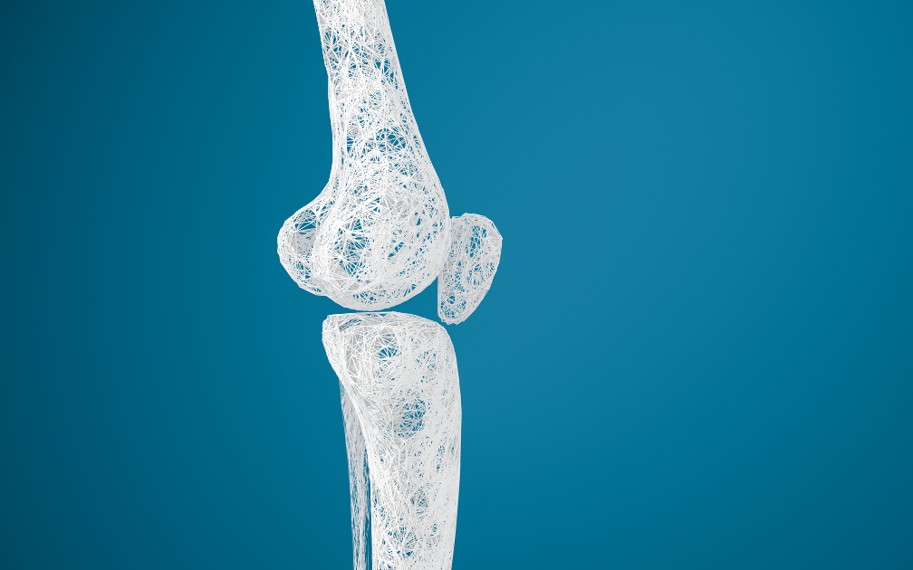 Things You Should Know About Osteoporosis: Insights from an Endocrinologist in Northwest Indiana