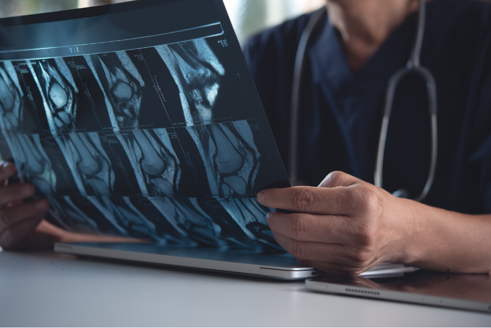 Is It Time to Consult a Rheumatologist? Insights from a Rheumatologist in Northwest Indiana