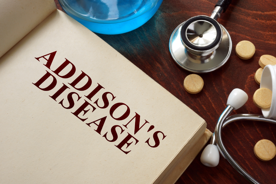 What Are the Signs of Addison’s Disease? Insights from an Endocrinologist in East Chicago, Indiana