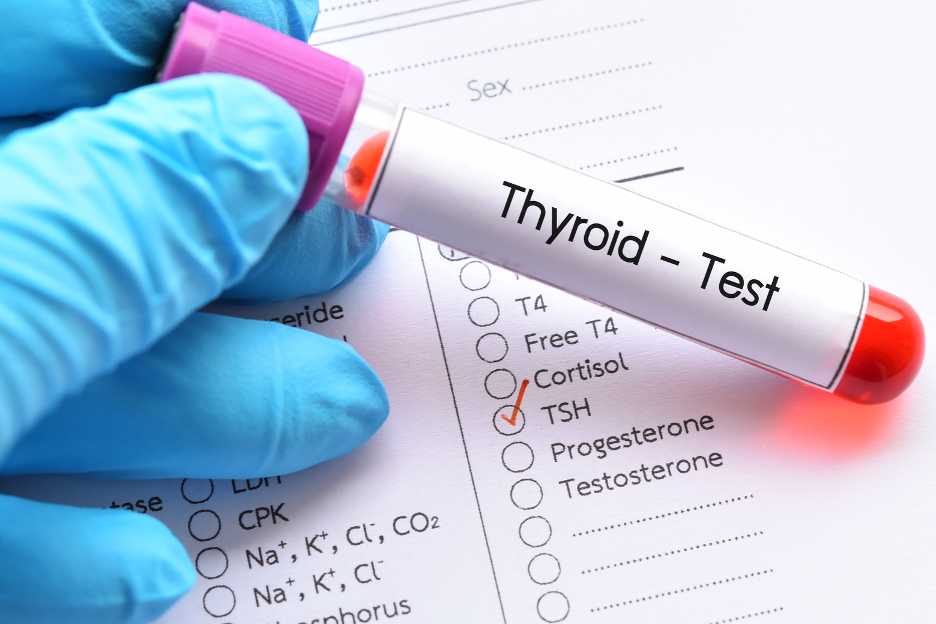 How Long Does It Usually Take to Get Thyroid Test Results Back? Insights from an Endocrinologist in East Chicago, Indiana